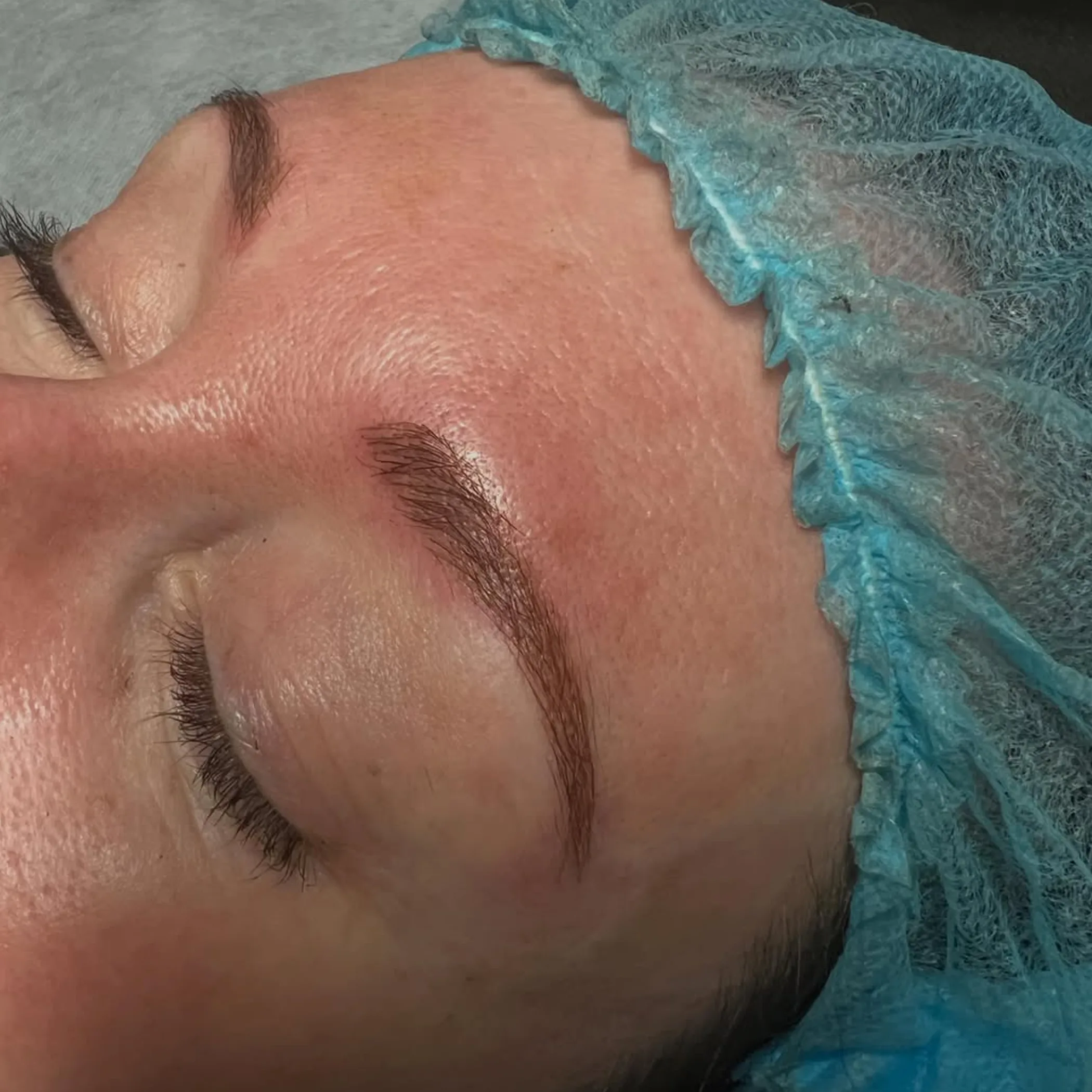 professional eyebrow tattoo removal laser session
